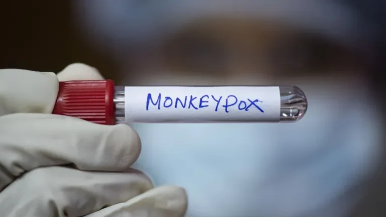 Senegal first case of monkeypox confirmed in Dakar