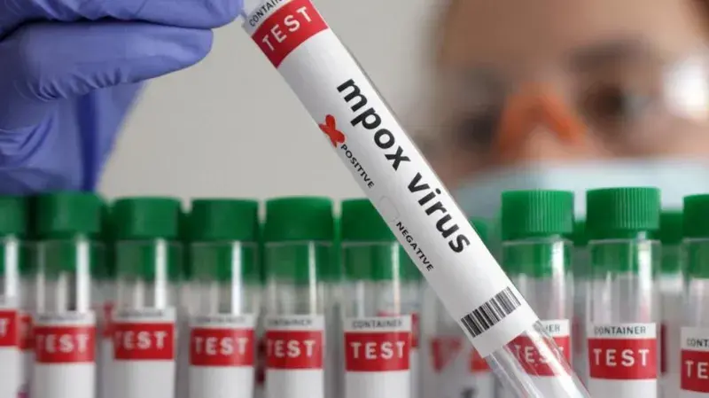 Senegal: first imported case of mpox successfully treated